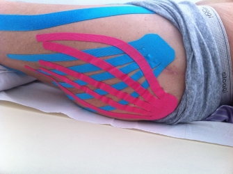 Kinesio taping